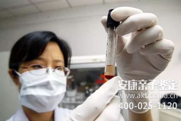 杭州上海亲子鉴定样本采集大全,做亲子鉴定口腔细胞怎么采集？ 
